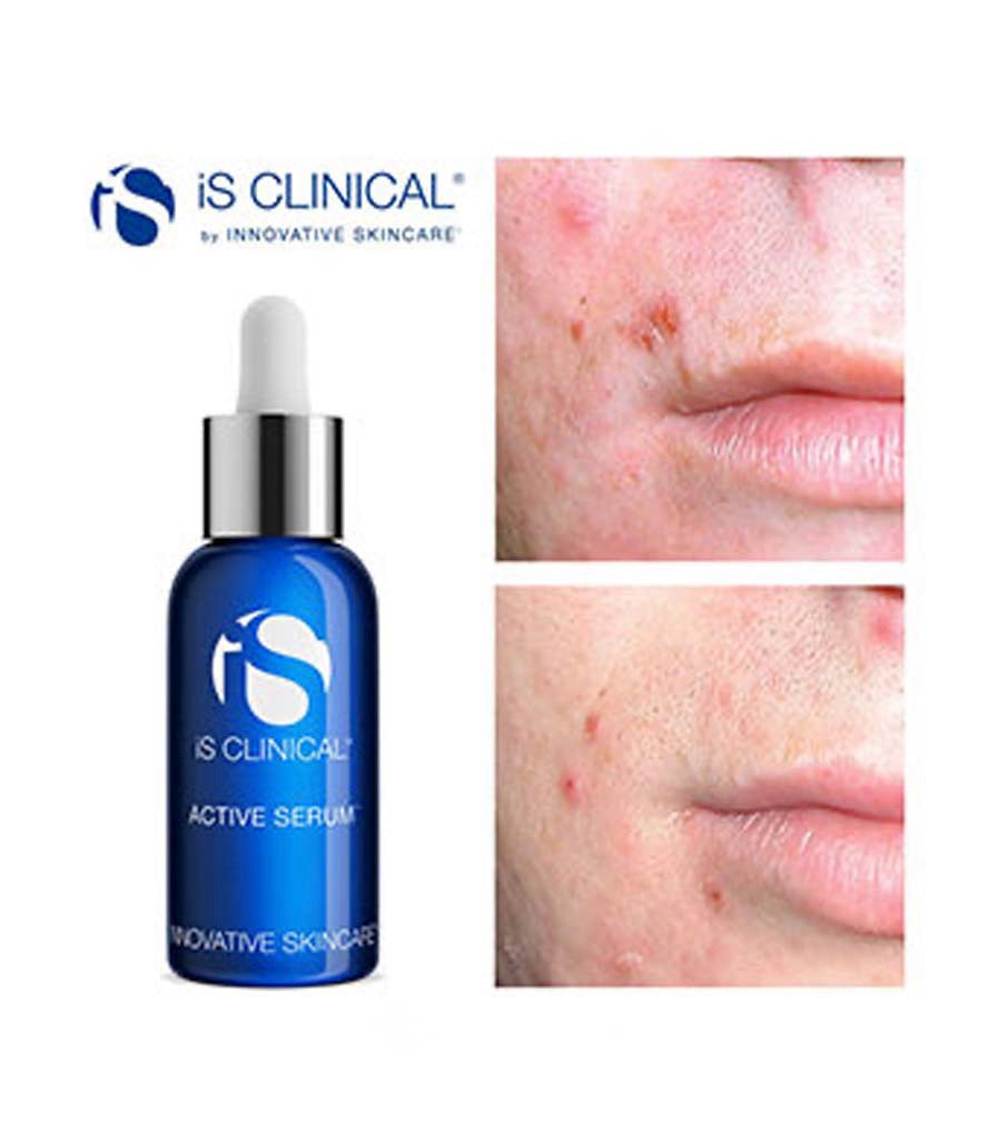 IS Clinical Active Serum - 15ml