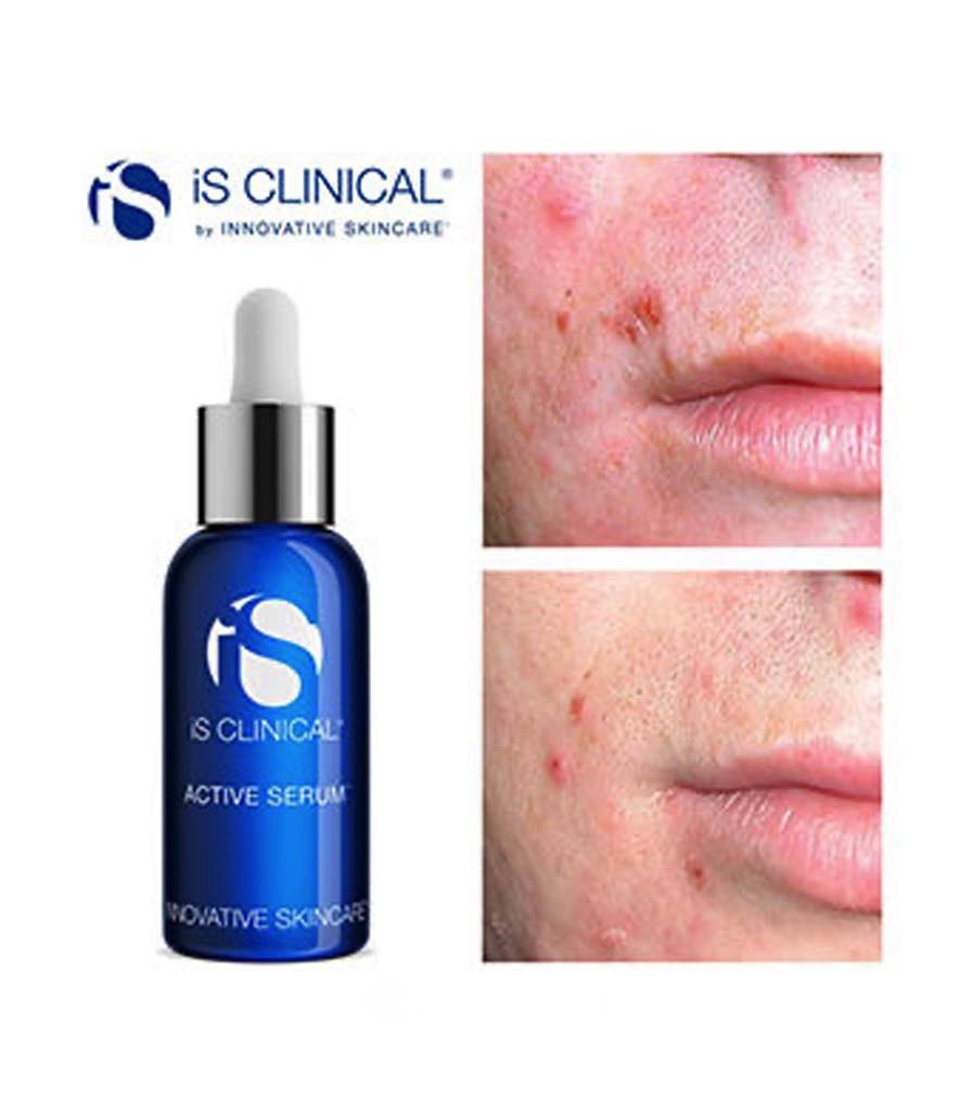 IS Clinical Active Serum - 30ml
