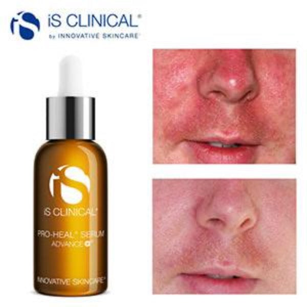 IS Clinical Proheal Serum Advance+ - 15ml