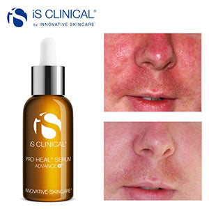 IS Clinical Proheal Serum Advance+ - 30ml